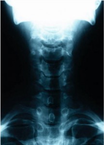 Bildiagnostik med röntgen