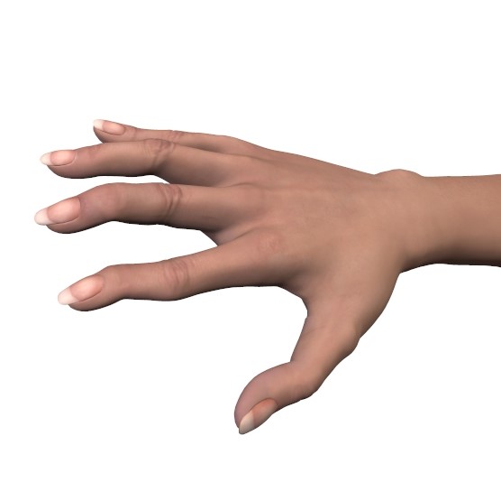 tecken på reumatism i händerna
